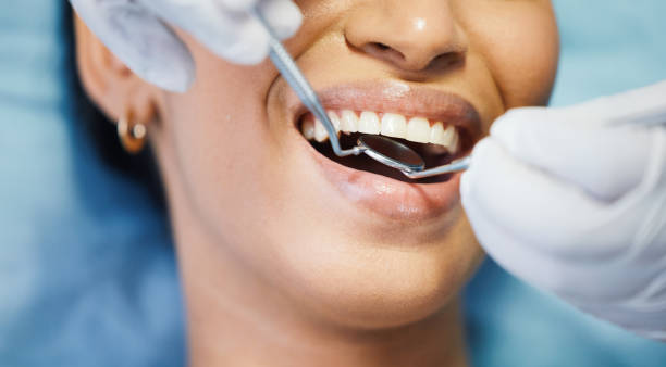 Best Emergency Root Canal Treatment in Lford, MI
